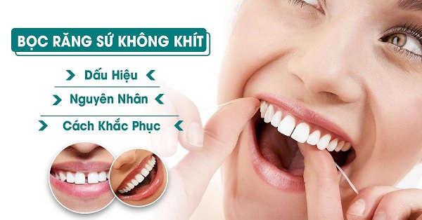 Bọc răng sứ 4 răng cửa uy tín và chất lượng.