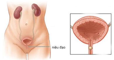 Sỏi niệu đạo: Nguyên nhân, triệu chứng và cách phòng ngừa