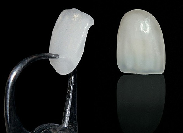 Nhược điểm của sứ Feldspathic là độ bền cơ học không cao
