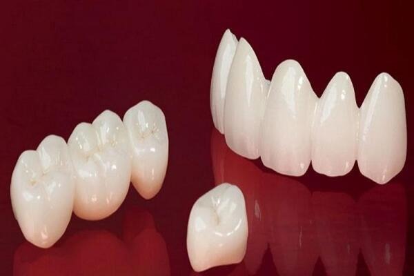 Ứng dụng của sứ Feldspathic