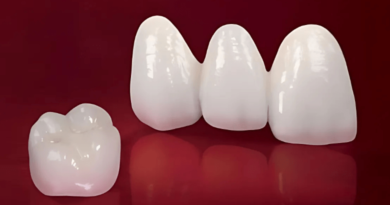Vật liệu răng sứ