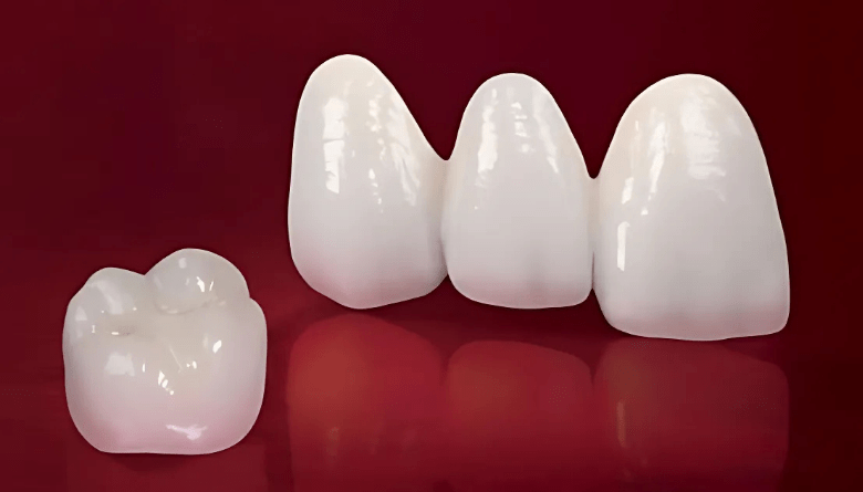 Vật liệu răng sứ